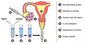 2 IVF