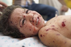 A-wounded-Palestinian-child-cries-while-receiving-medical-care-at-a-hospital-in-Khan-Younis-in-the-southern-Gaza-Strip-on-Wednesday-following-an-Israeli-military-strike-AFP-photo-by-Mohammed-Abed